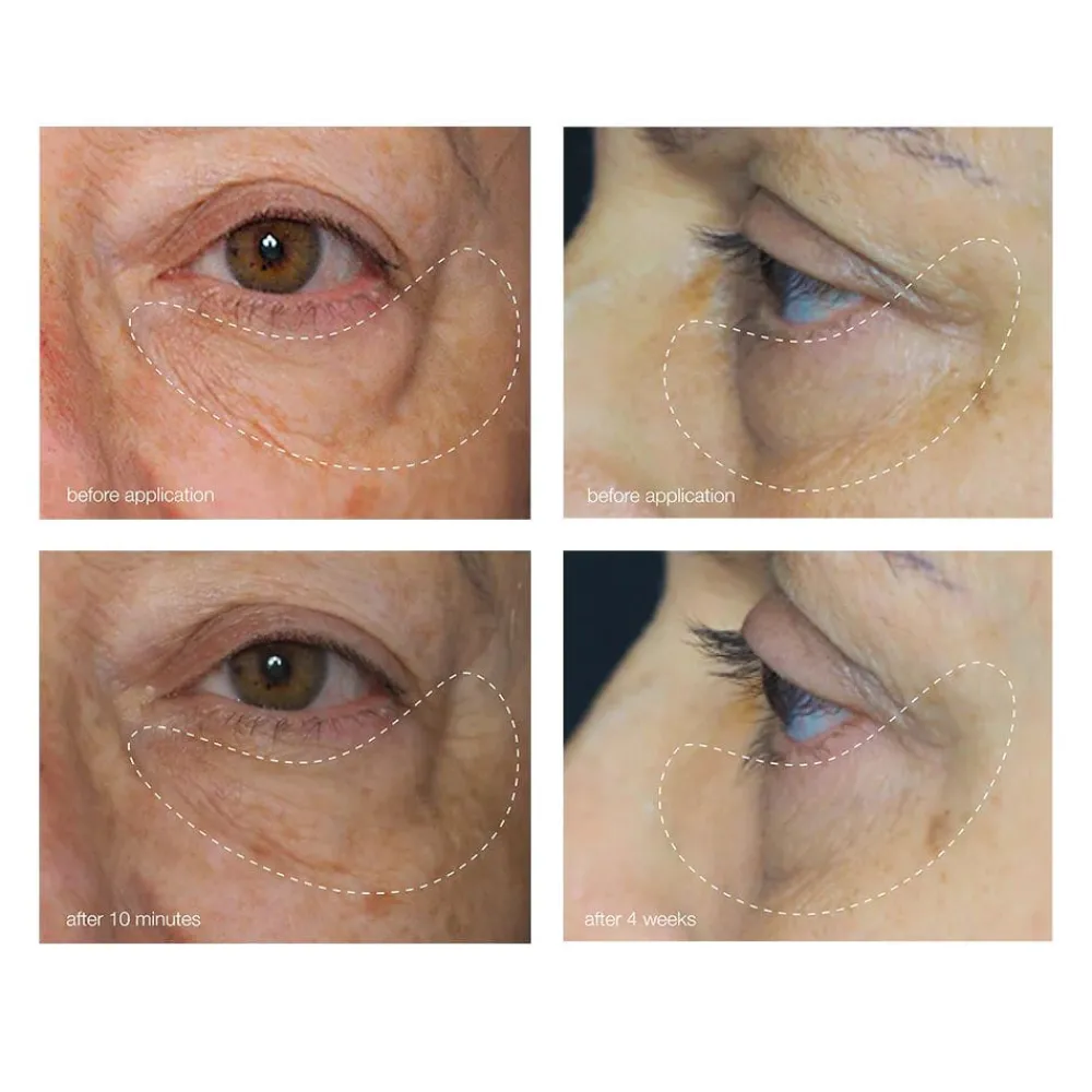 Dermalogica Awaken Peptide Eye Gel Sale