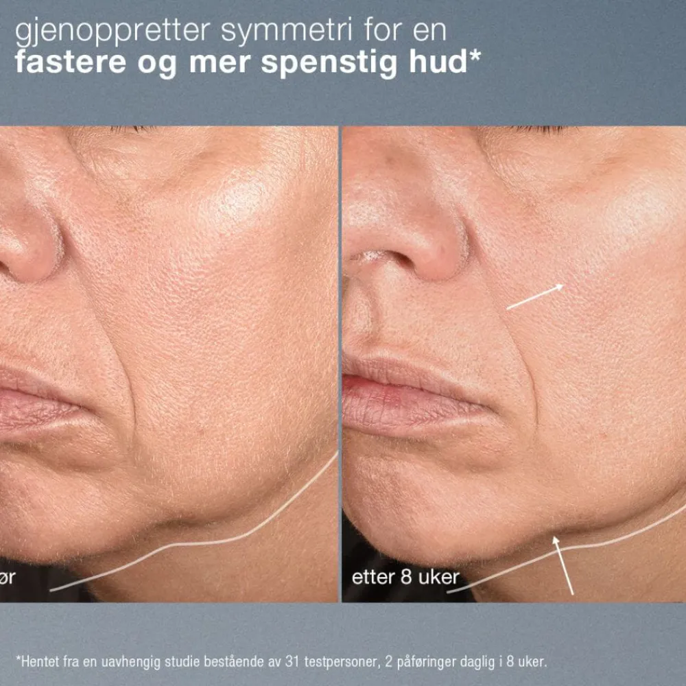 Dermalogica Neurotouch Symmetry Serum Sale