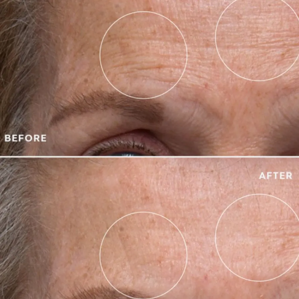 Elemis Pro-Collagen Renewal Serum Online