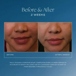 iS Clinical Daily Dynamic Hydrator Hot