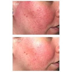 iS Clinical Pro-Heal Serum Advance+ 30 ml Discount