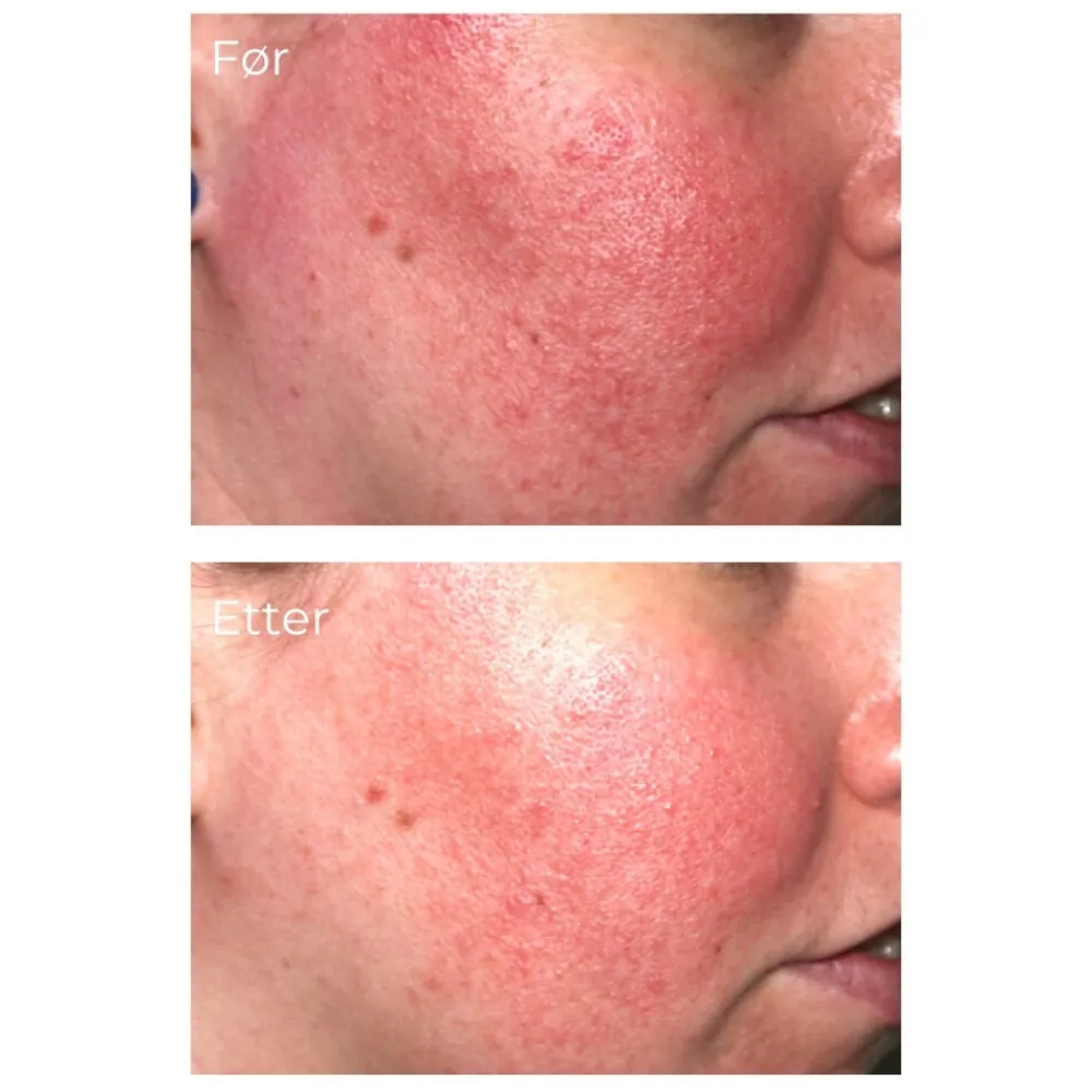 iS Clinical Pro-Heal Serum Advance+ 15 ml Outlet
