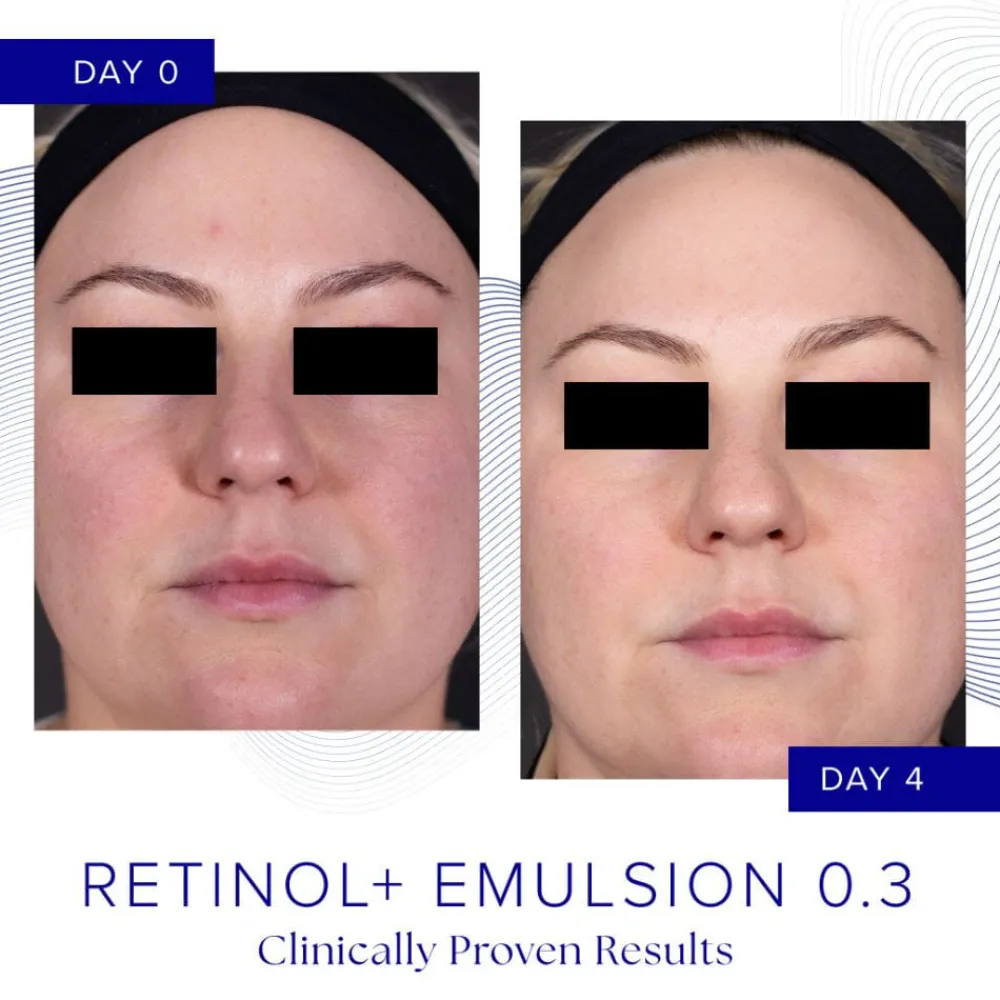 iS Clinical Retinol+ Emulsion 0.3 Online