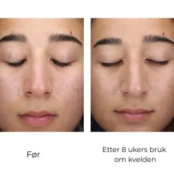 Skinbetter-Science Skinbetter AlphaRet Clearing Serum Discount