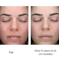 Skinbetter-Science Skinbetter AlphaRet Clearing Serum Discount