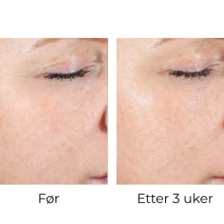 Skinbetter-Science Skinbetter AlphaRet Peel Pads (1stk) Clearance