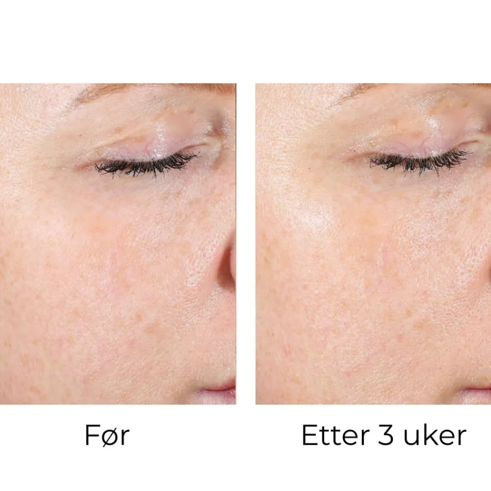 Skinbetter-Science Skinbetter AlphaRet Peel Pads (1stk) Clearance