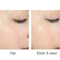 Skinbetter-Science Skinbetter AlphaRet Peel Pads (1stk) Clearance