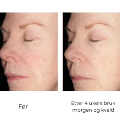 Skinbetter-Science Skinbetter Alto Defense Serum Face New
