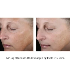 Skinbetter-Science Skinbetter Even Tone Correcting Serum New