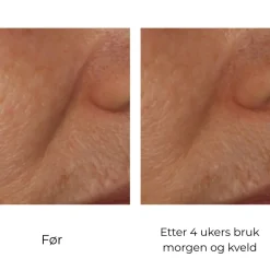 Skinbetter-Science Skinbetter InterFuse Intensive Treatment Lines Online