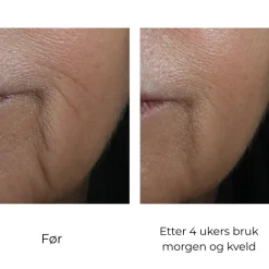Skinbetter-Science Skinbetter InterFuse Intensive Treatment Lines Online