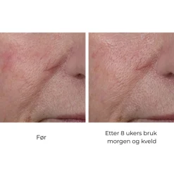 Skinbetter-Science Skinbetter InterFuse Treatment Cream Face & Neck Clearance