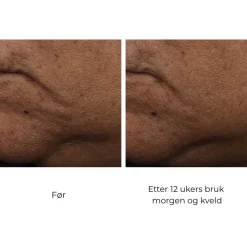Skinbetter-Science Skinbetter InterFuse Treatment Cream Face & Neck Clearance