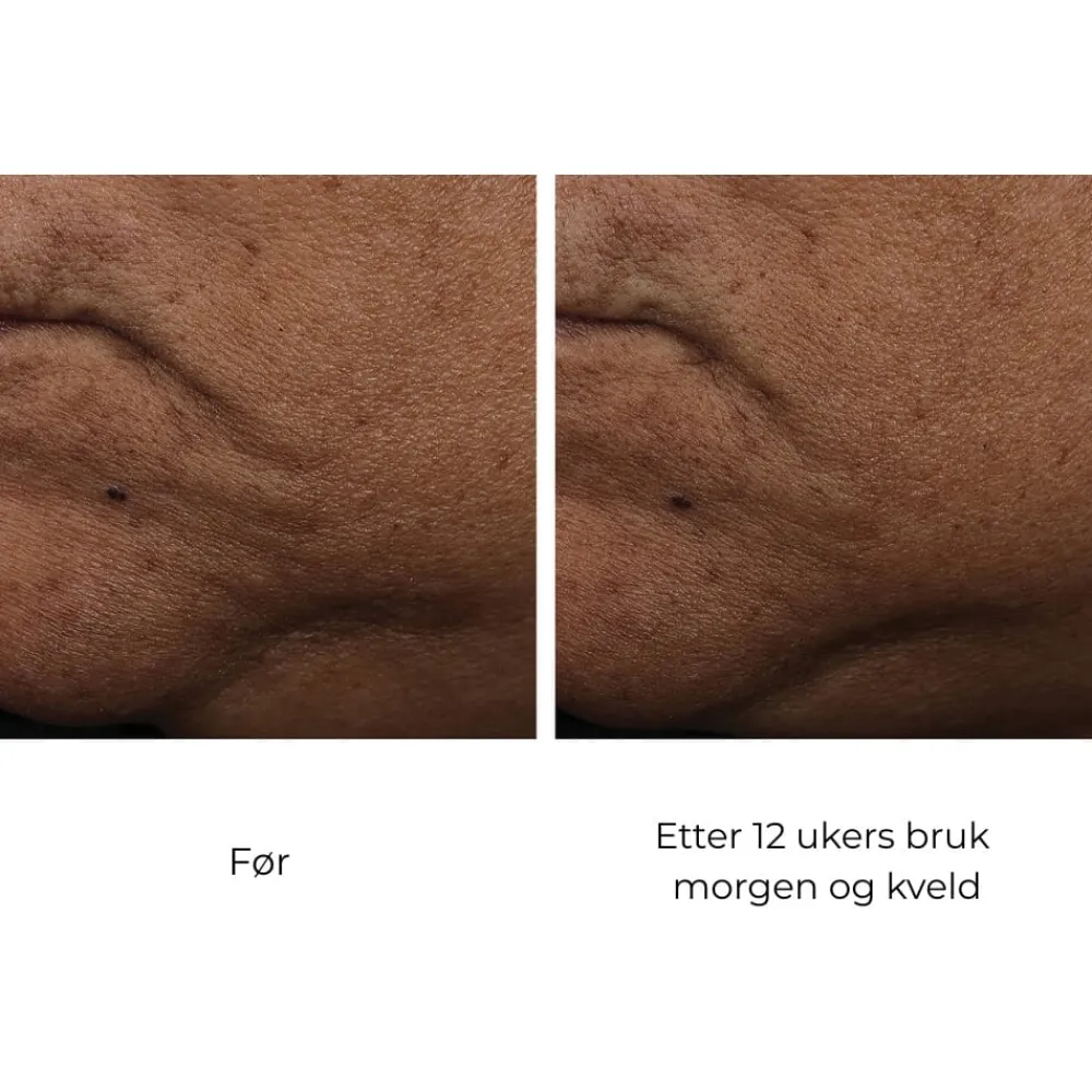 Skinbetter-Science Skinbetter InterFuse Treatment Cream Face & Neck Clearance