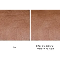 Skinbetter-Science Skinbetter InterFuse Treatment Cream Face & Neck Clearance