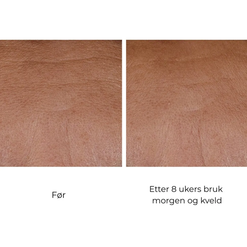 Skinbetter-Science Skinbetter InterFuse Treatment Cream Face & Neck Clearance