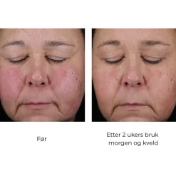 Skinbetter-Science Skinbetter Mystro Active Balance Serum Clearance