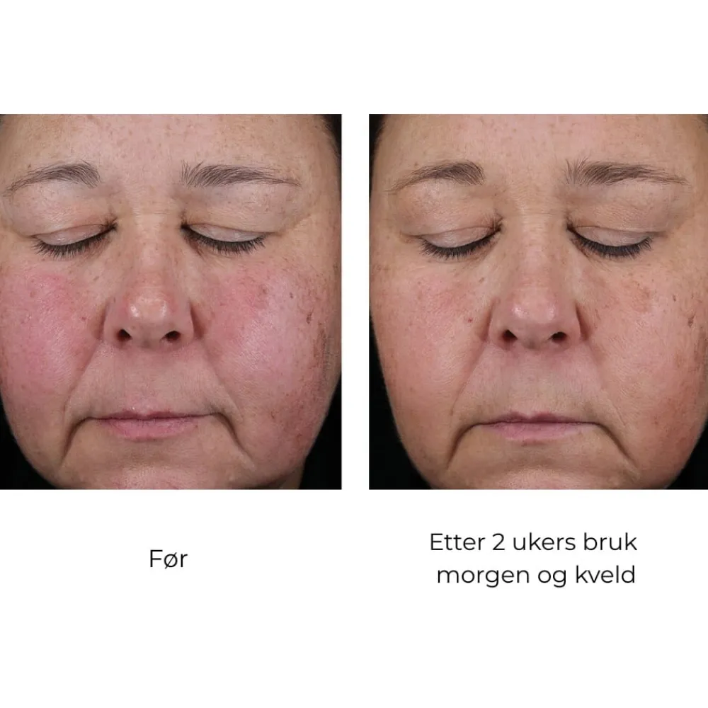 Skinbetter-Science Skinbetter Mystro Active Balance Serum Clearance