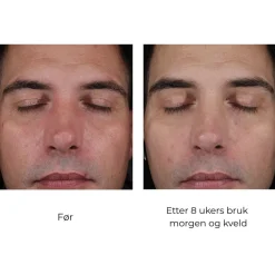 Skinbetter-Science Skinbetter Mystro Active Balance Serum Clearance