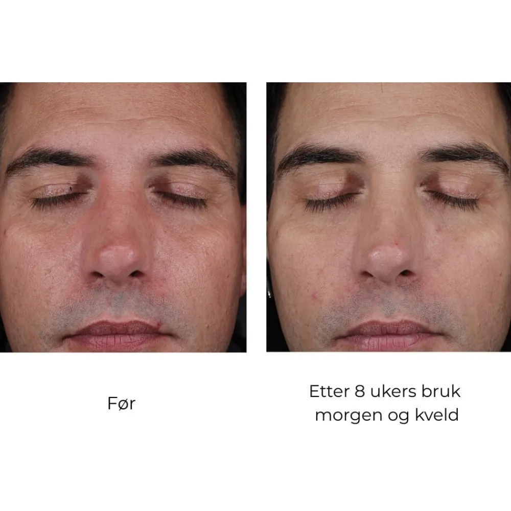 Skinbetter-Science Skinbetter Mystro Active Balance Serum Clearance