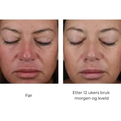 Skinbetter-Science Skinbetter Mystro Active Balance Serum Clearance