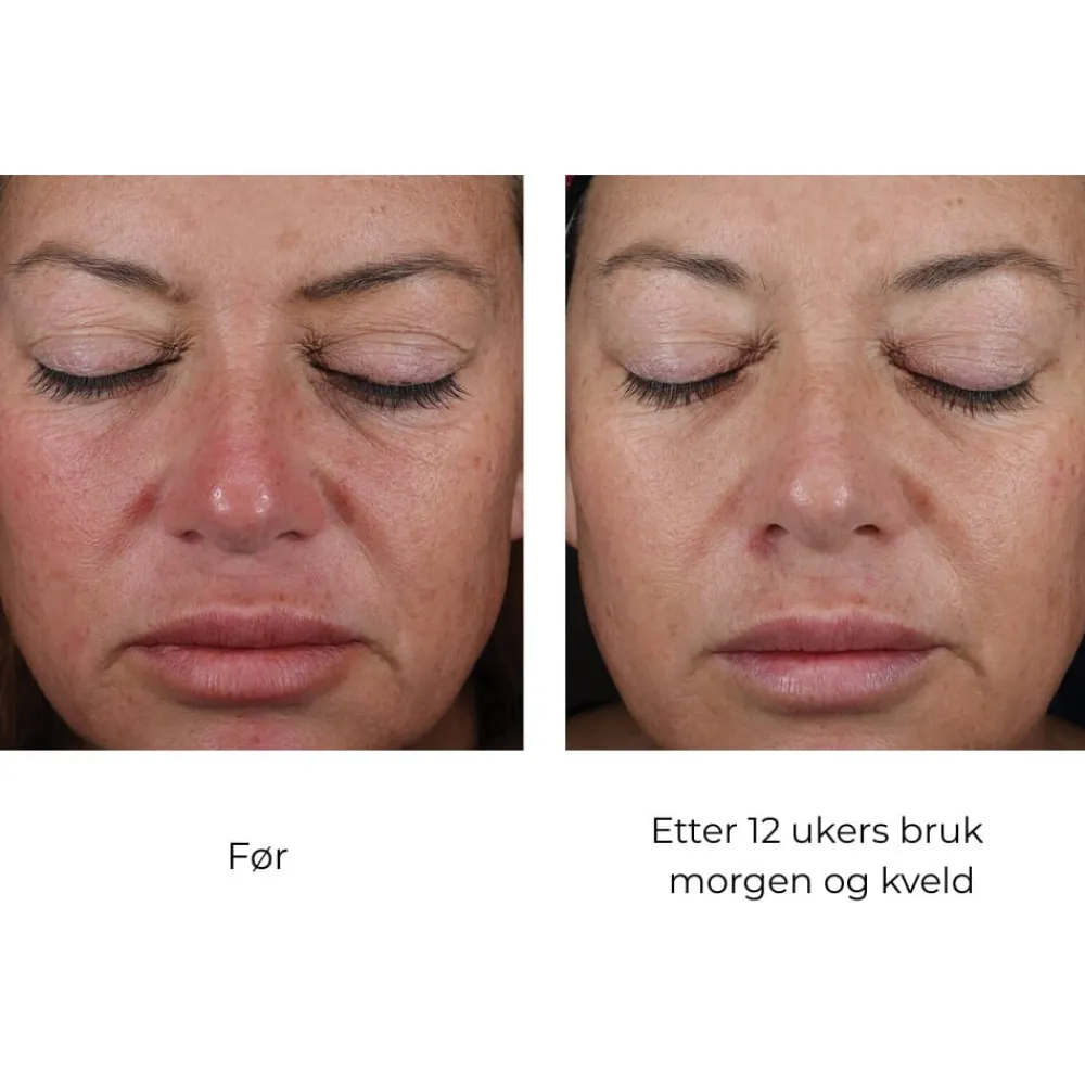 Skinbetter-Science Skinbetter Mystro Active Balance Serum Clearance