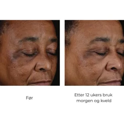 Skinbetter-Science Skinbetter Mystro Active Balance Serum Clearance