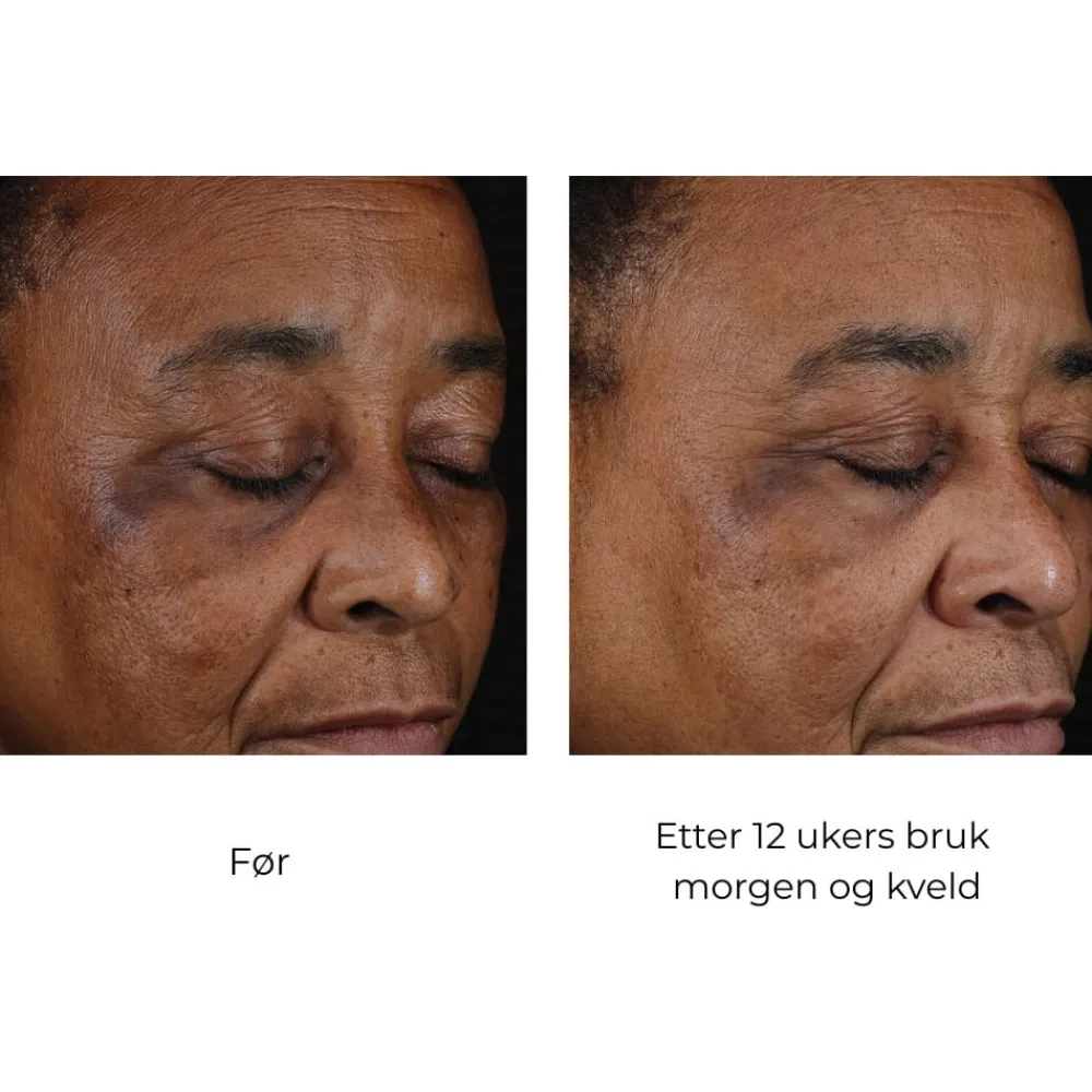 Skinbetter-Science Skinbetter Mystro Active Balance Serum Clearance