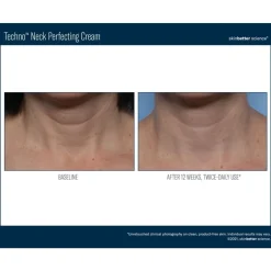Skinbetter-Science Skinbetter Techno Neck Perfecting Cream Discount