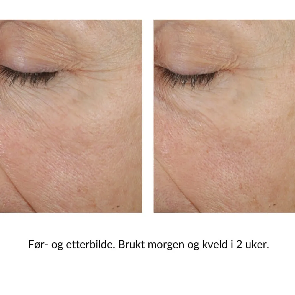 Skinbetter-Science Skinbetter Trio Rebalancing Moisture Treatment Discount