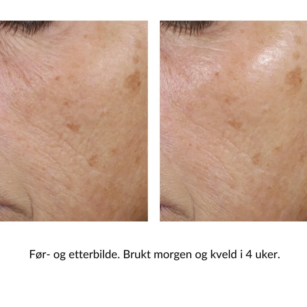 Skinbetter-Science Skinbetter Trio Rebalancing Moisture Treatment Discount